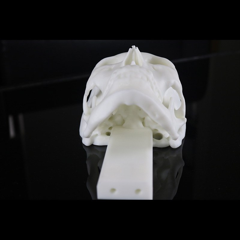 Material de resina de impresión 3D SLA para la planificación preoperatoria del cráneo