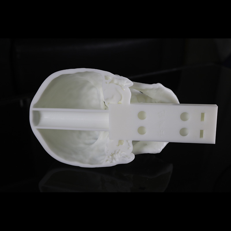 Material de resina de impresión 3D SLA para la planificación preoperatoria del cráneo