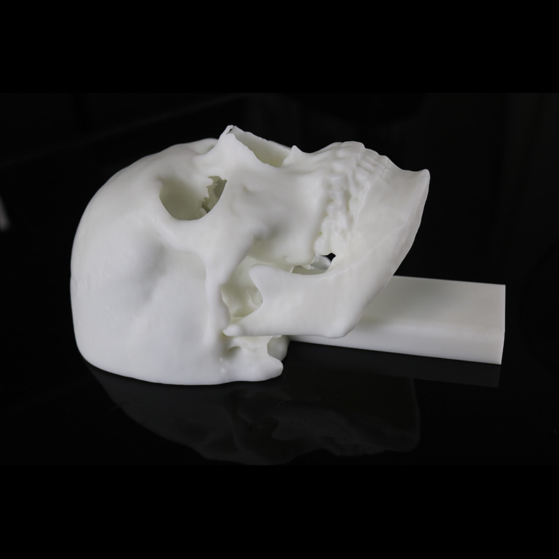 Material de resina de impresión 3D SLA para la planificación preoperatoria del cráneo